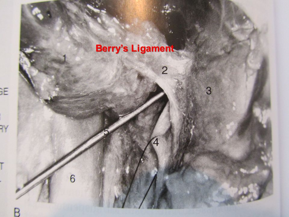 Surgical Anatomy Thyroid And Parathyroid Glands Ppt Video Online Download Surgical Anatomy Thyroid And Parathyroid Glands Ppt Video Online Download