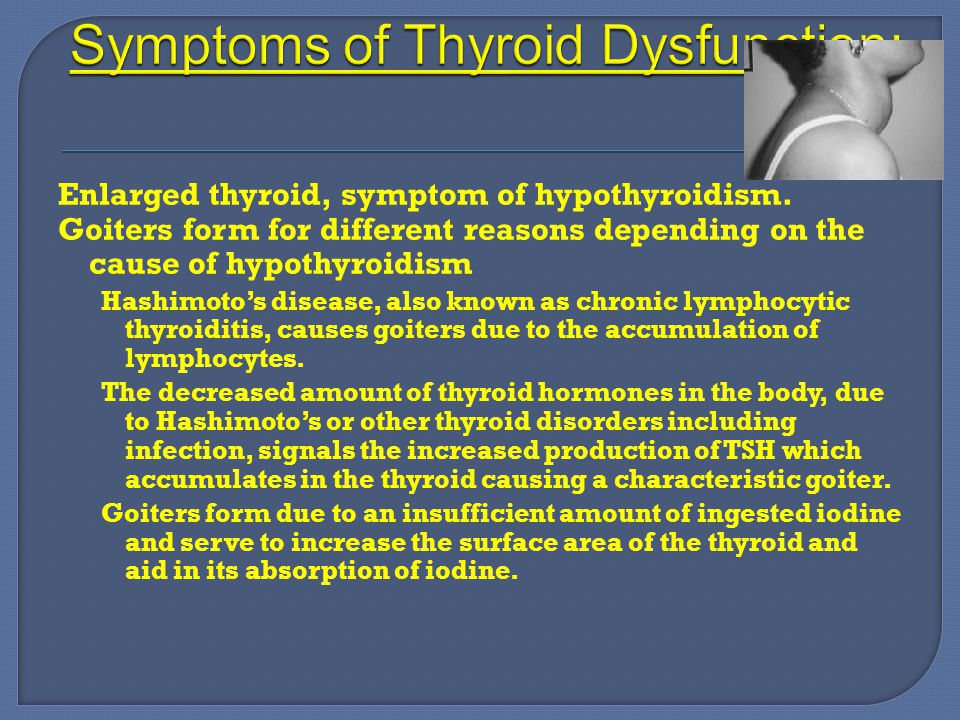 Symptoms of Thyroid Dysfunction: Goiter
