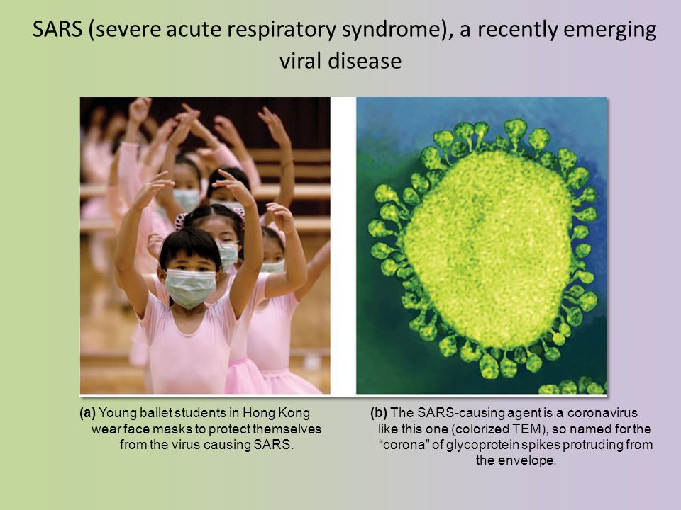 SARS (severe acute respiratory syndrome), a recently emerging viral disease