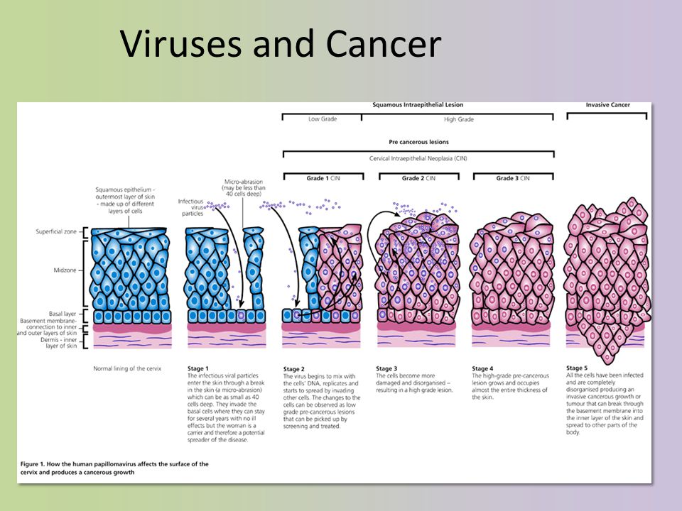 Viruses and Cancer