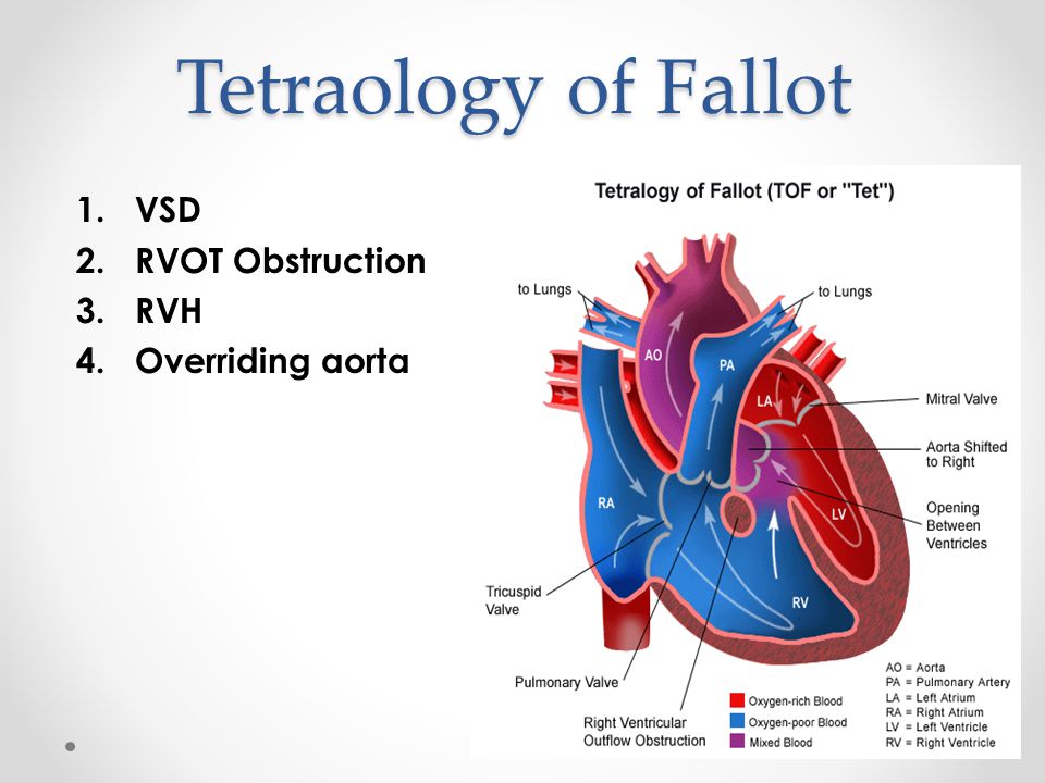 Cyanotic Heart Lesions Ppt Video Online Download