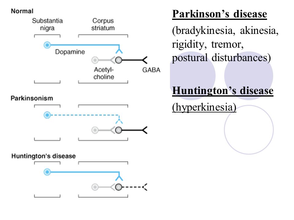 Parkinson Disease Ppt Video Online Download