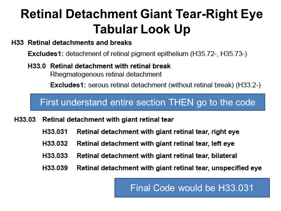 Retinal Detachment Giant Tear-Right Eye Tabular Look Up