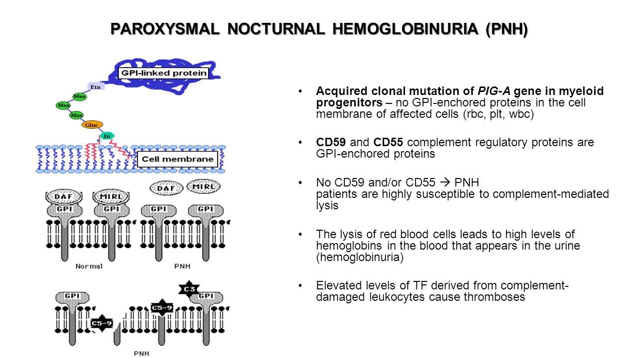 PAROXYSMAL NOCTURNAL HEMOGLOBINURIA (PNH)