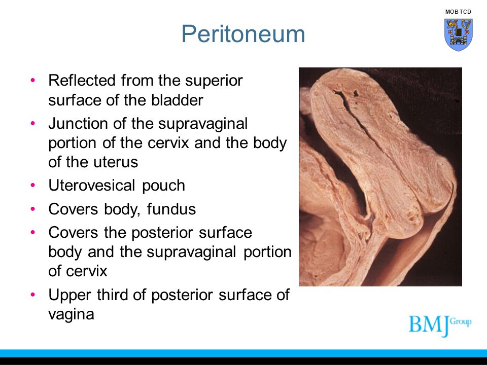 Peritoneum Reflected from the superior surface of the bladder