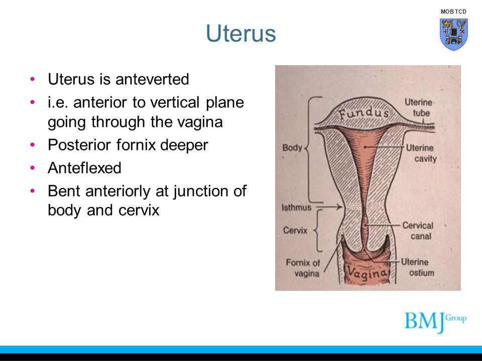 Uterus Uterus is anteverted
