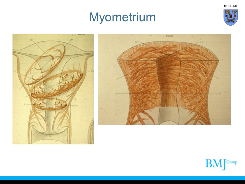 Myometrium MOB TCD