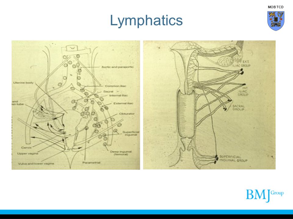 Lymphatics MOB TCD