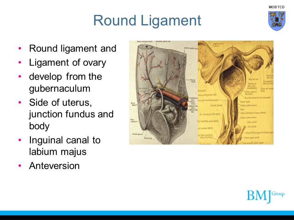 Round Ligament Round ligament and Ligament of ovary