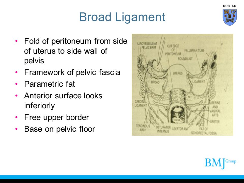 Broad Ligament MOB TCD. Fold of peritoneum from side of uterus to side wall of pelvis. Framework of pelvic fascia.