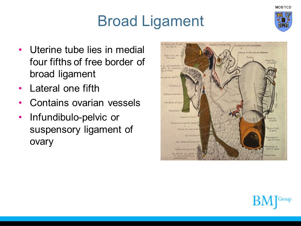 Broad Ligament MOB TCD. Uterine tube lies in medial four fifths of free border of broad ligament. Lateral one fifth.
