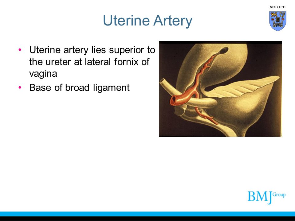 Uterine Artery MOB TCD. Uterine artery lies superior to the ureter at lateral fornix of vagina.
