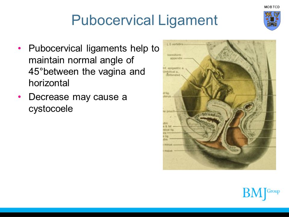 Pubocervical Ligament