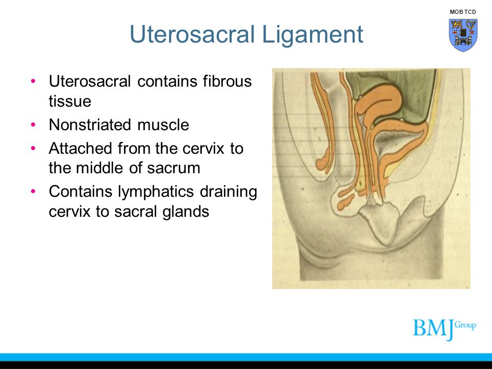 Uterosacral Ligament Uterosacral contains fibrous tissue