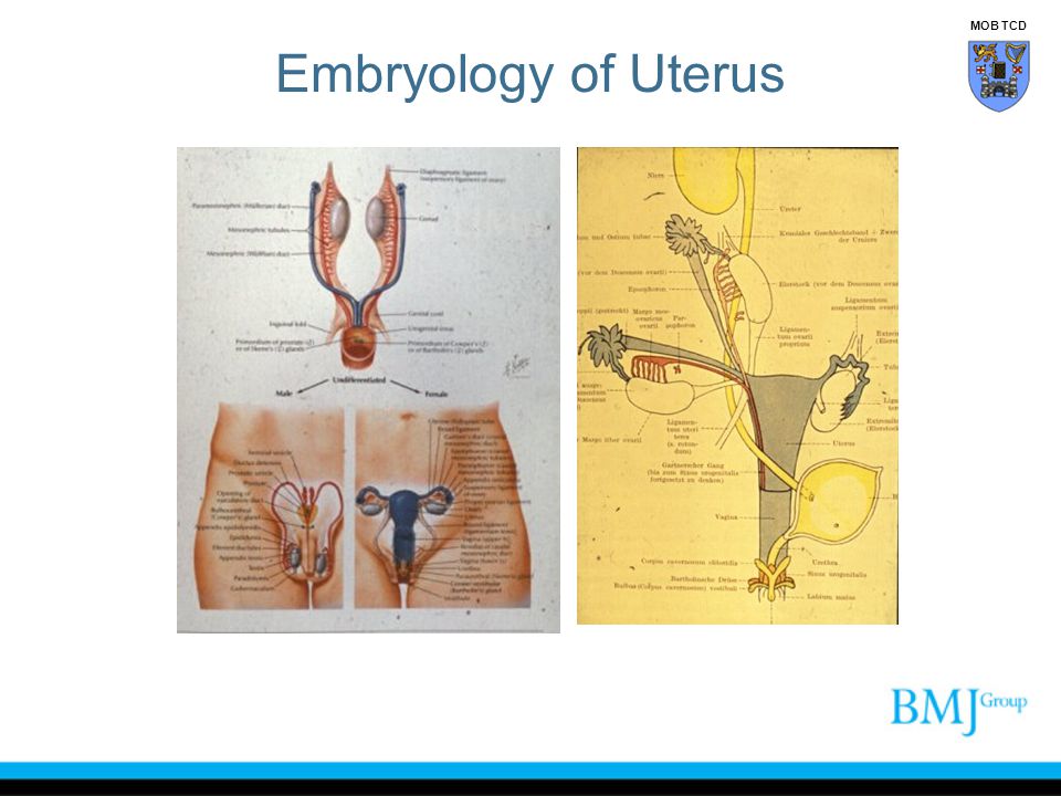 Embryology of Uterus MOB TCD