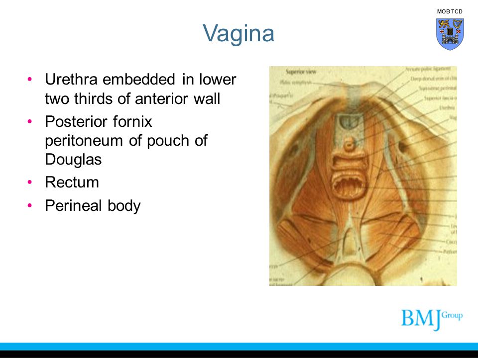 Vagina Urethra embedded in lower two thirds of anterior wall