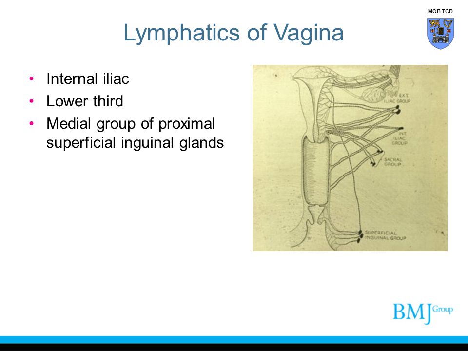 Lymphatics of Vagina Internal iliac Lower third