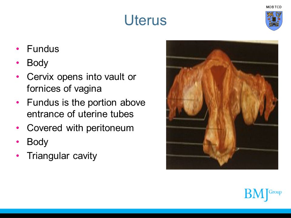 Uterus Fundus Body Cervix opens into vault or fornices of vagina