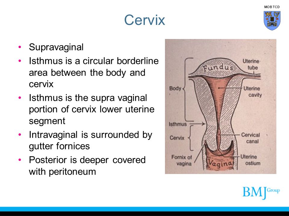 Cervix MOB TCD. Supravaginal. Isthmus is a circular borderline area between the body and cervix.