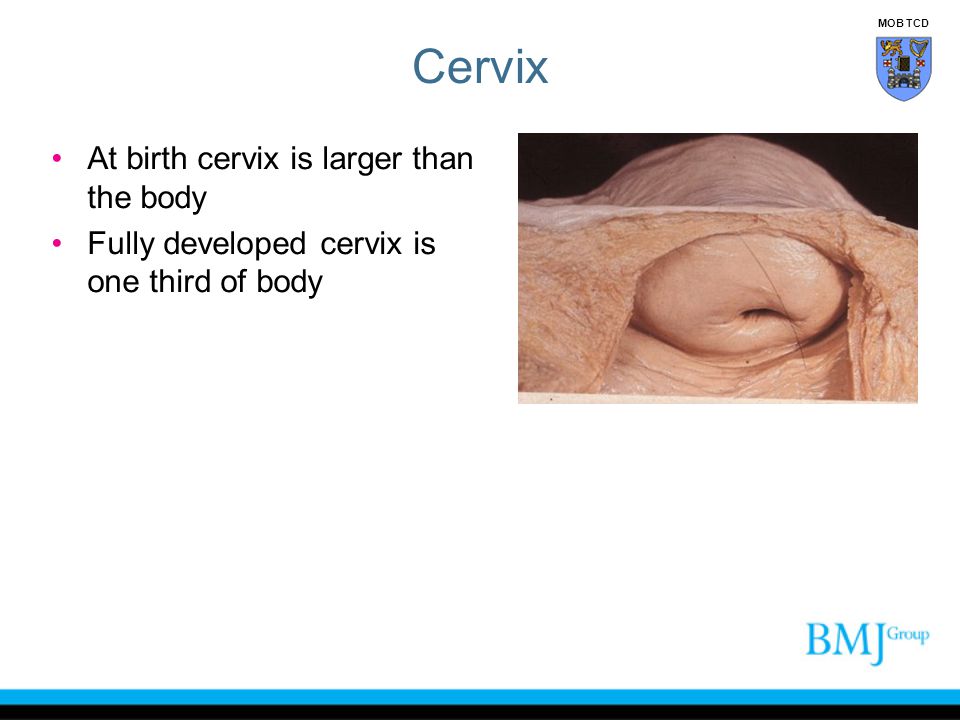 Cervix At birth cervix is larger than the body
