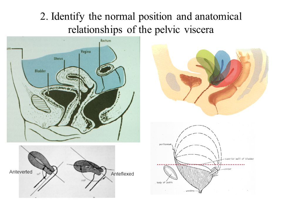 2. Identify the normal position and anatomical relationships of the pelvic viscera