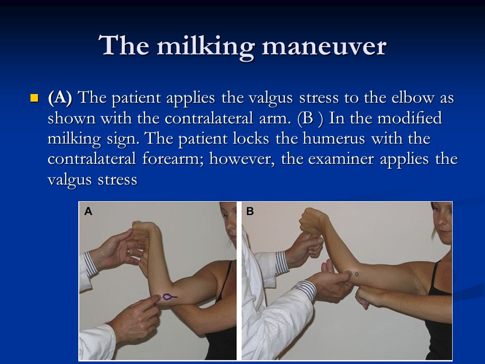 Management of elbow instability in adults ppt video online download Management of elbow instability in adults ppt video online download