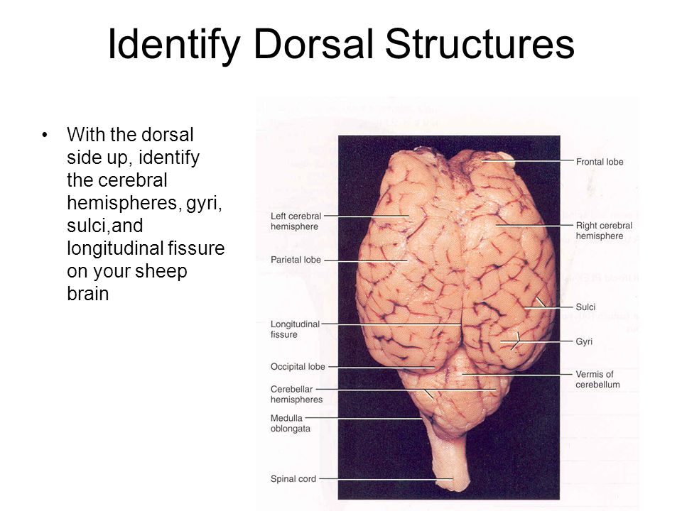 Sheep Brain Dissection Guide Ppt Video Online Download