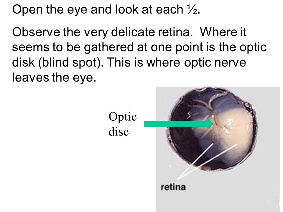 Open the eye and look at each ½.