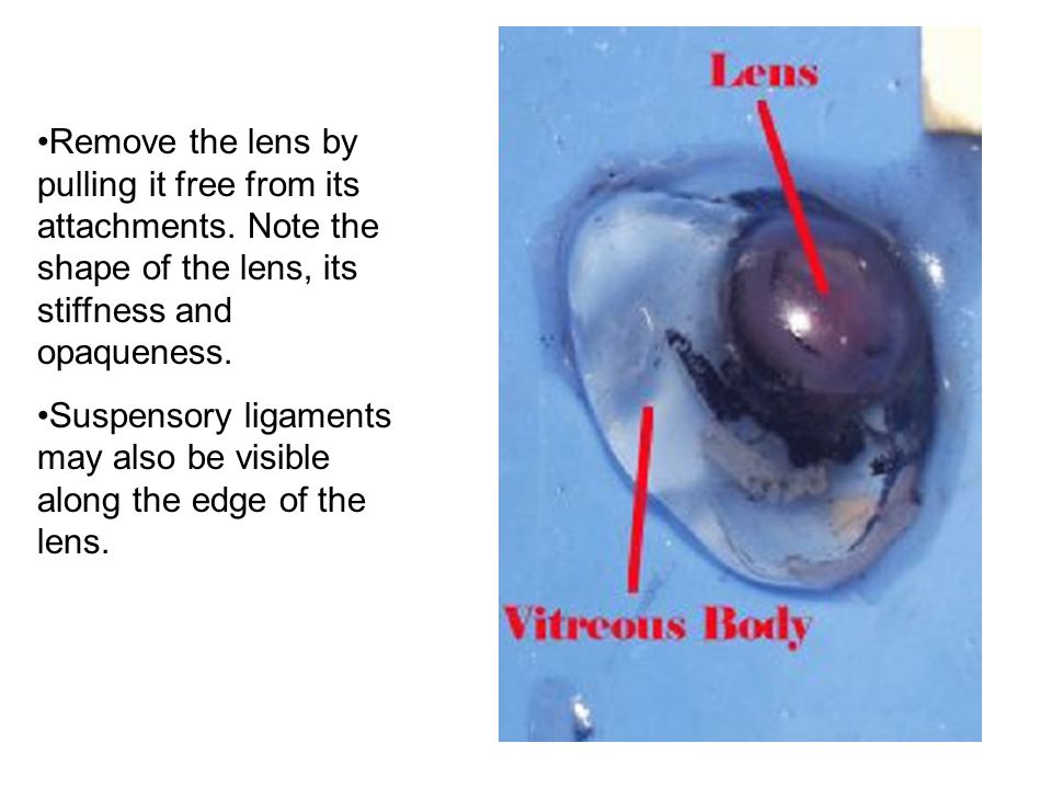Remove the lens by pulling it free from its attachments