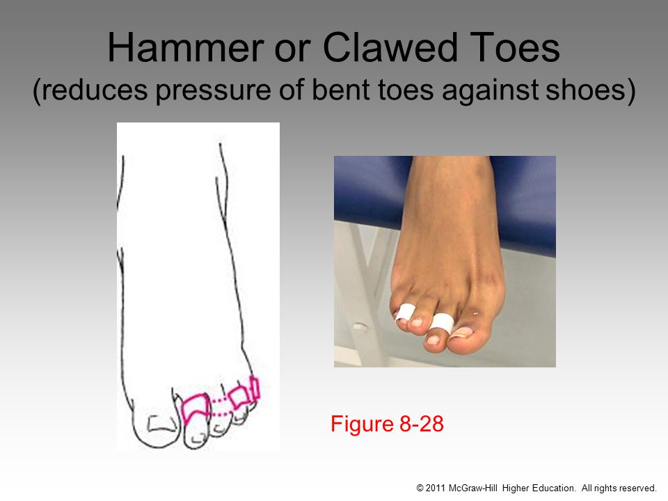 Chapter 8: Bandaging and Taping - ppt video online download