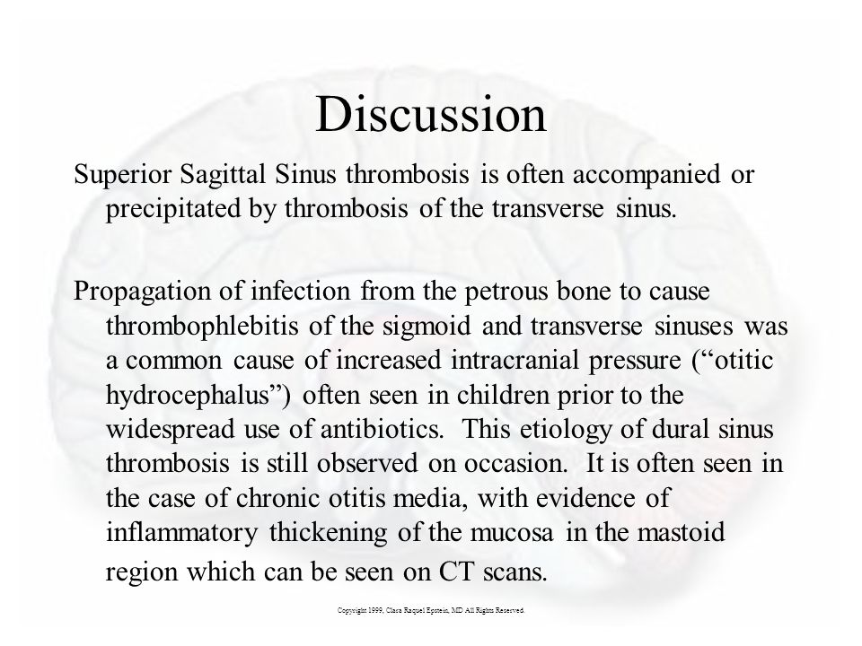 Superior Sagittal Sinus And Transverse Sinus Thrombosis Ppt Video