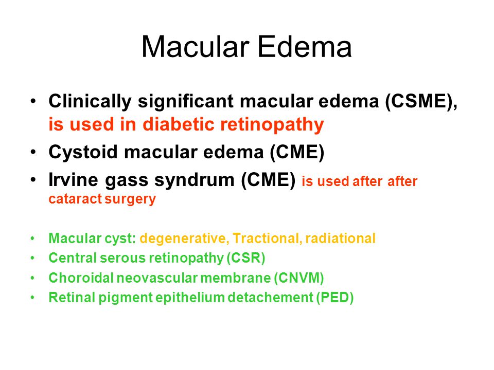 macular oedema causes)