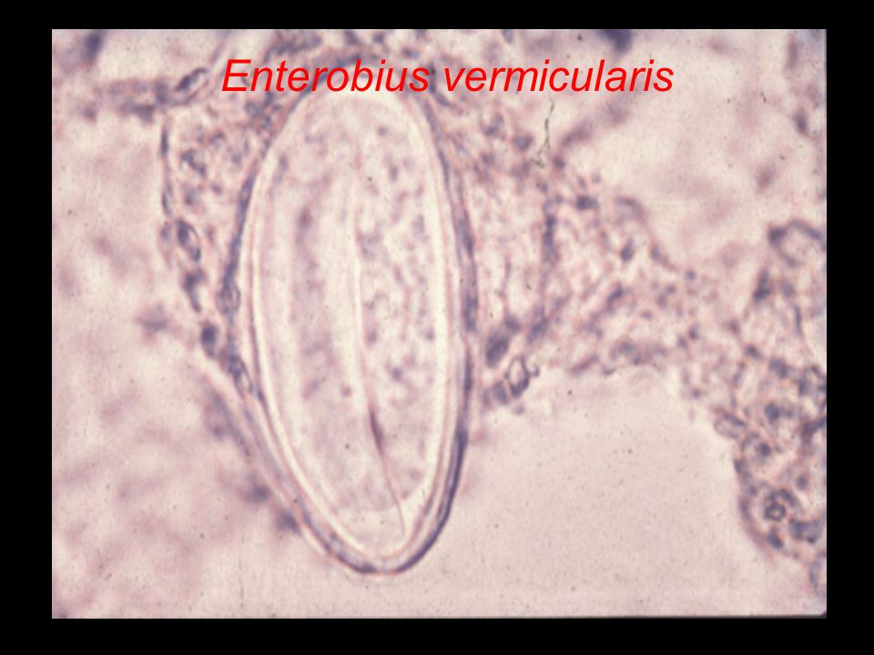 Enterobius vermicularis hogyan szerezheti be