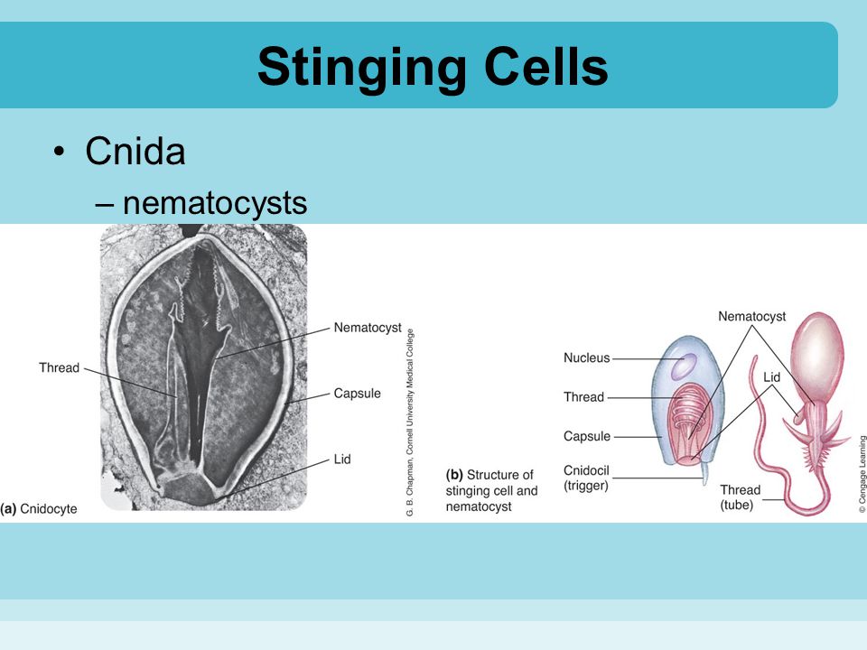 Stinging Cells Cnida nematocysts