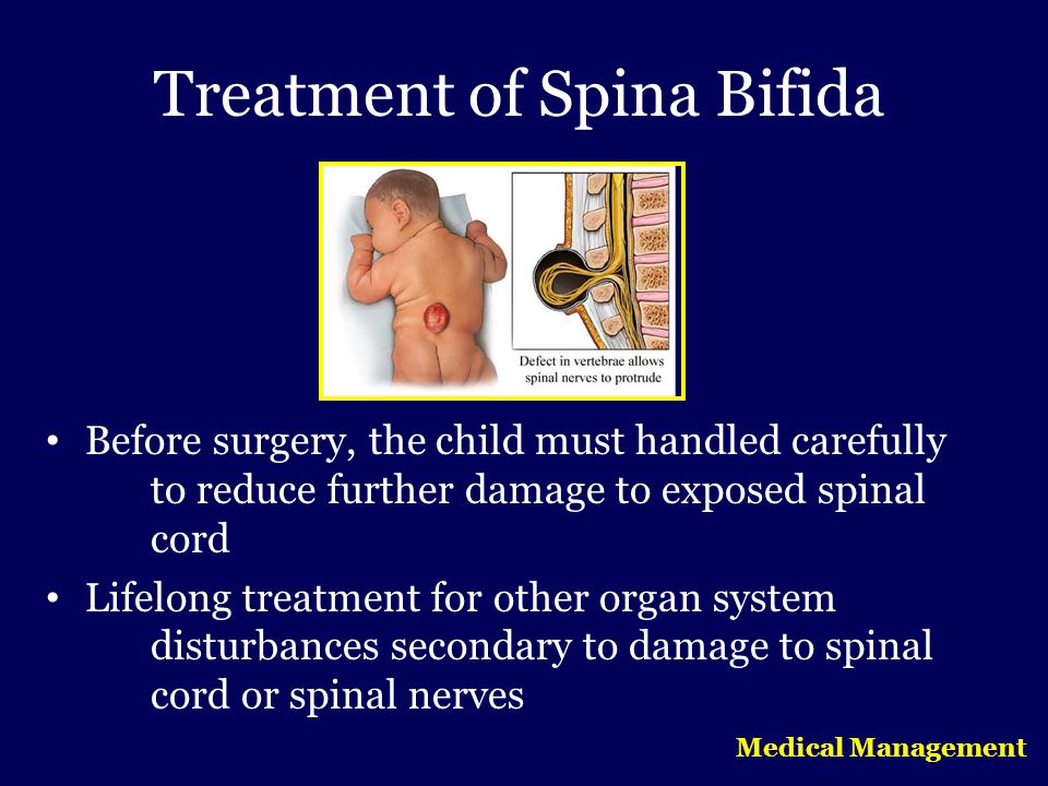 Pictures Of Girls With Spina Bifida