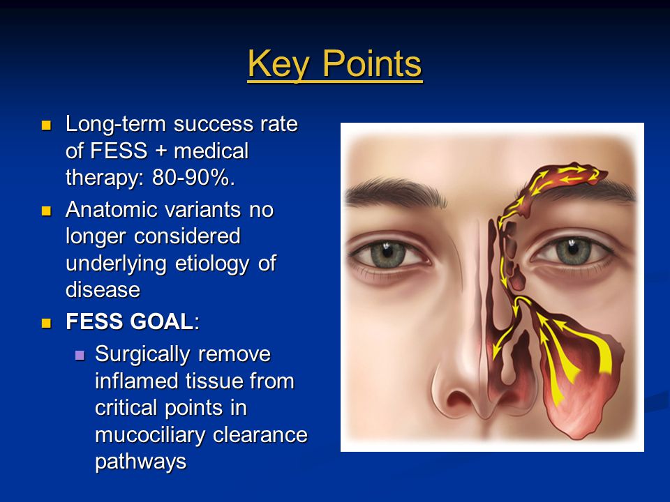 Concepts Of Endoscopic Sinus Surgery Causes Of Failure Ppt Download