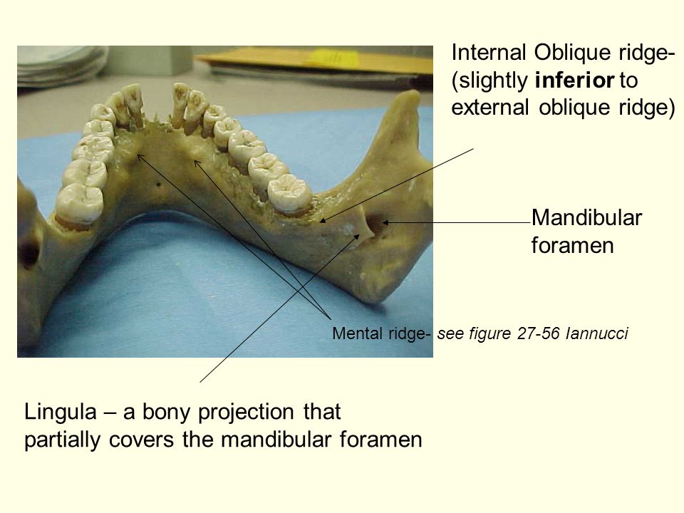 And their radiographic appearance ppt video online download