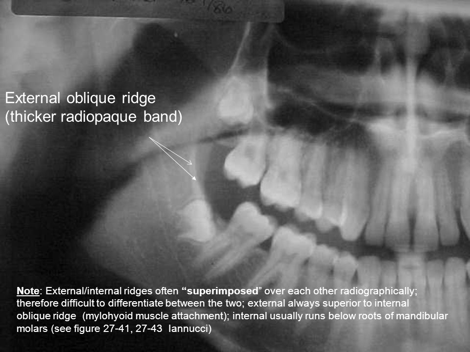 And their radiographic appearance ppt video online download