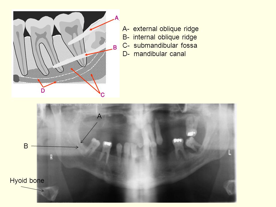 And their radiographic appearance ppt video online download