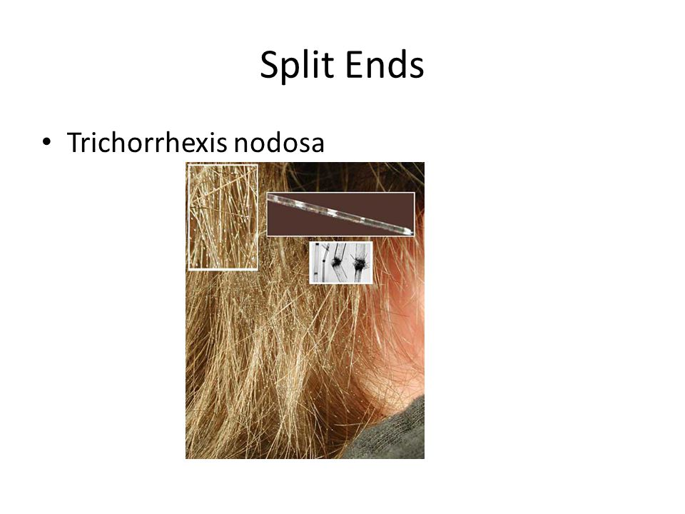 Split ends для волос что это такое