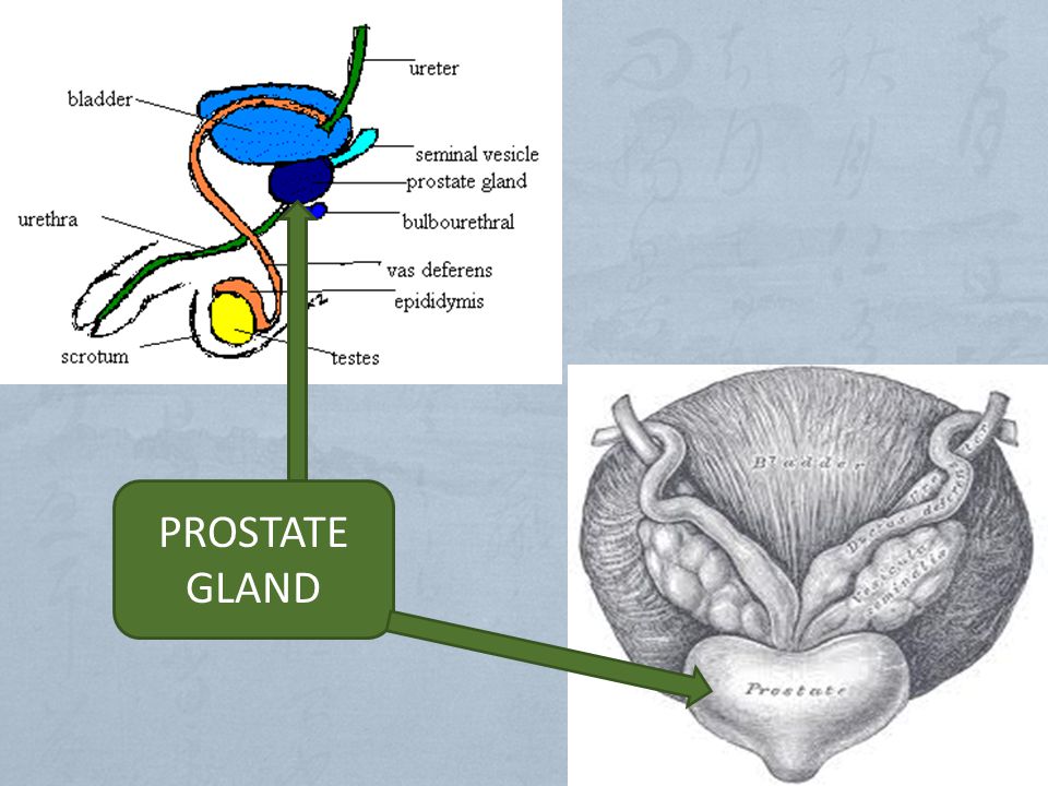 Prostate Gland. Предстательная железа включения