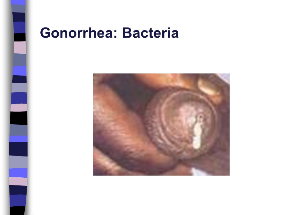 Gonorrhea: Bacteria