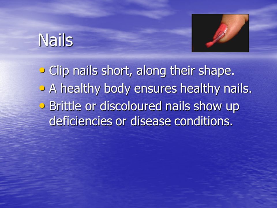 Nails Clip nails short, along their shape.
