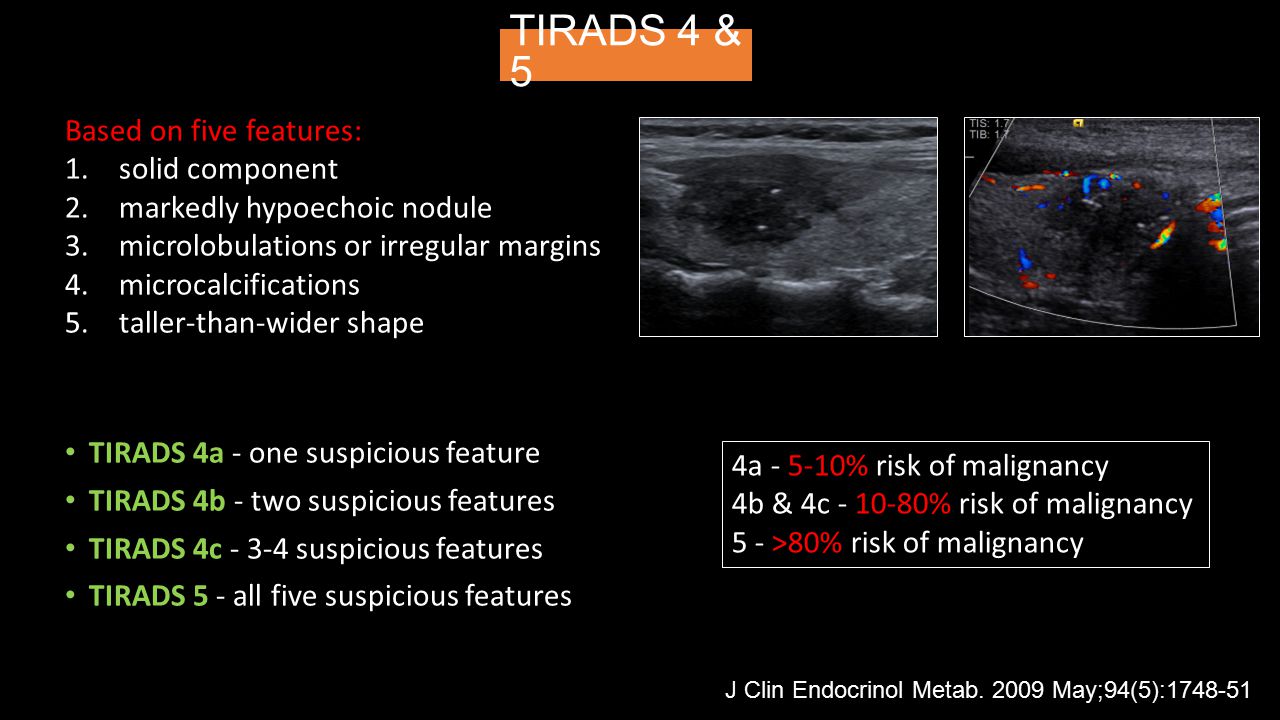 Rads 3 что это значит. Tirads 3 щитовидная железа. Шкала тирадс для УЗИ щитовидной железы. Tirads классификация узлов щитовидной железы УЗИ. Узел щитовидной железы Tirads 4.