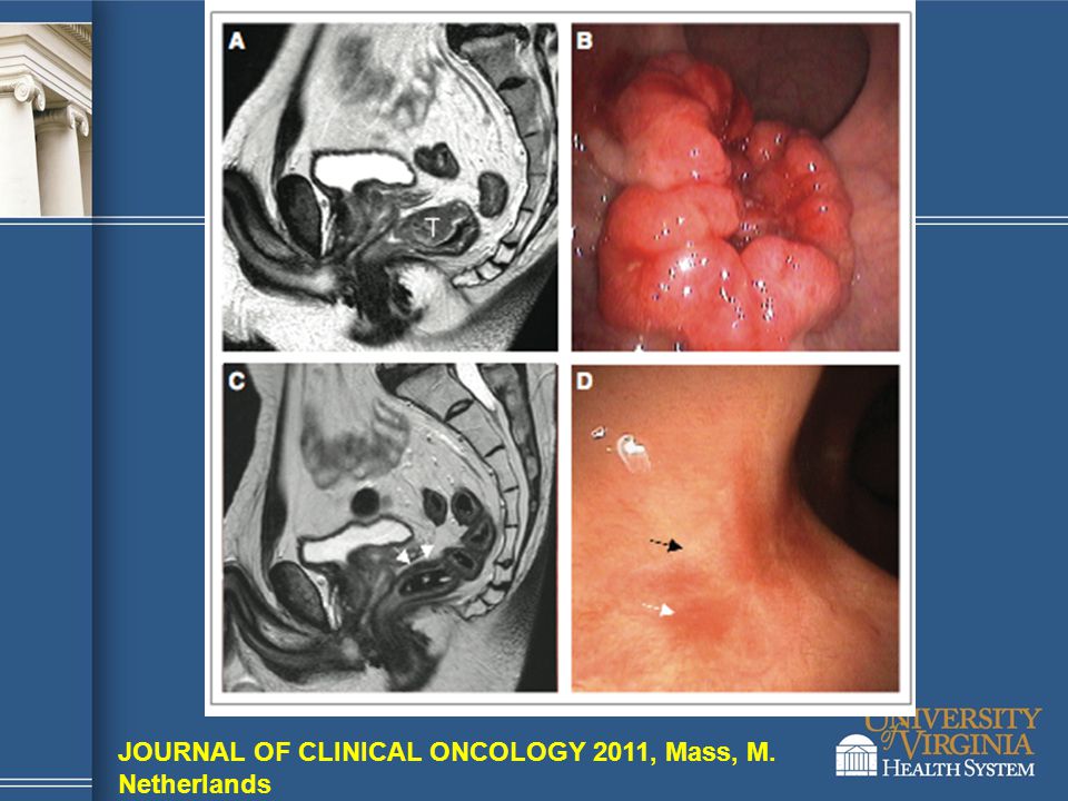JOURNAL OF CLINICAL ONCOLOGY 2011, Mass, M.