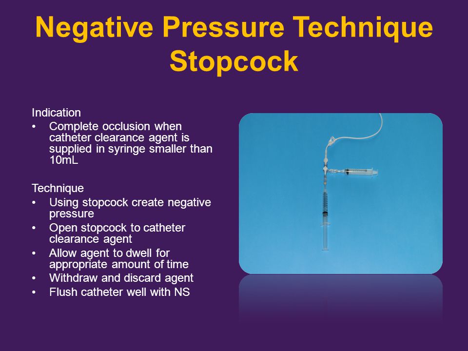 Negative Pressure Technique Stopcock