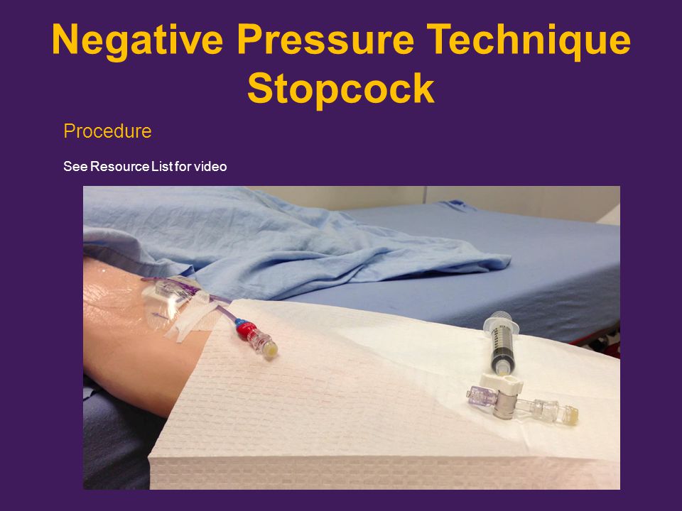 Negative Pressure Technique Stopcock