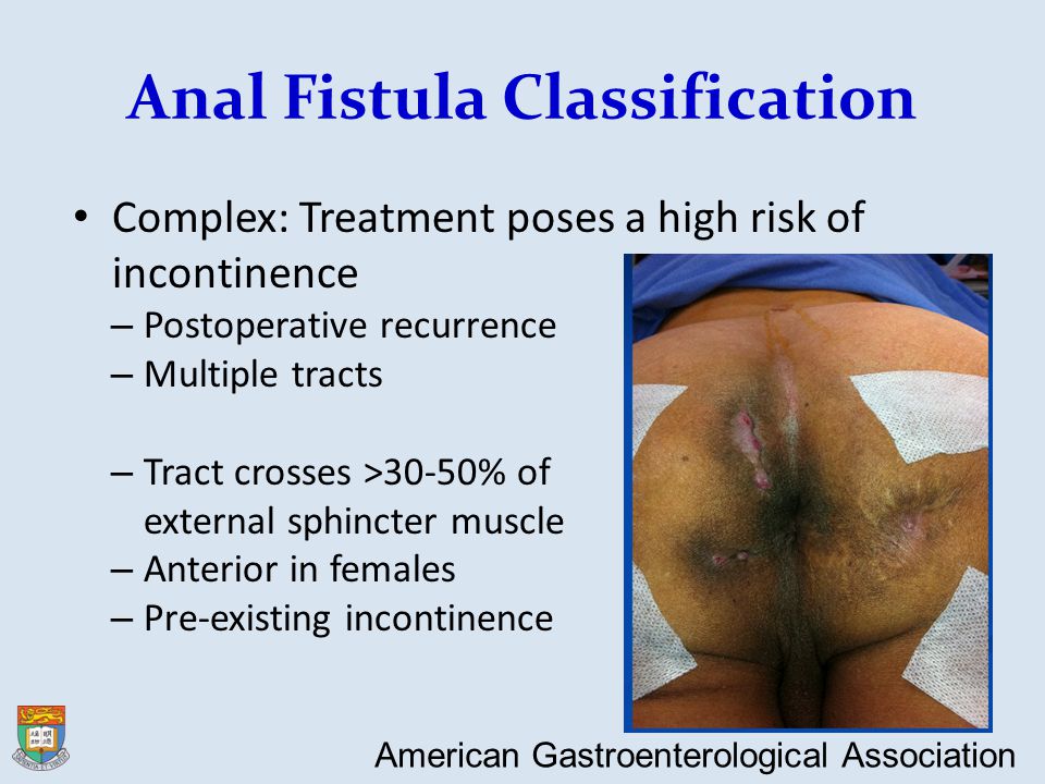 Anorectal Diagnostic Overview