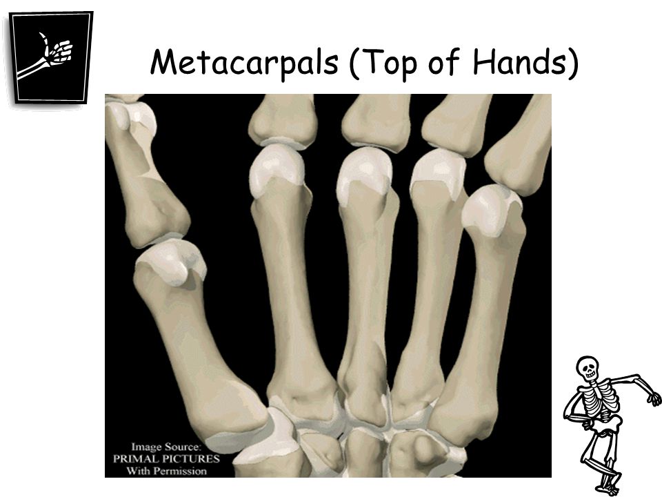 Metacarpals (Top of Hands)