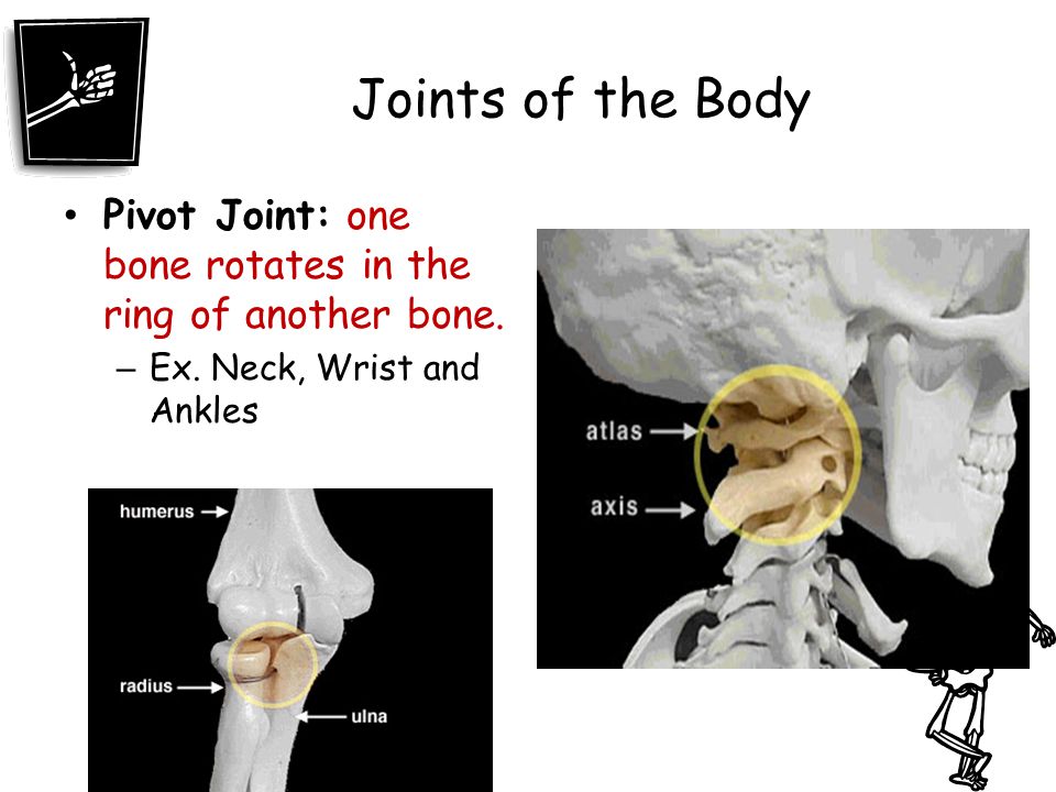 Joints of the Body Pivot Joint: one bone rotates in the ring of another bone.